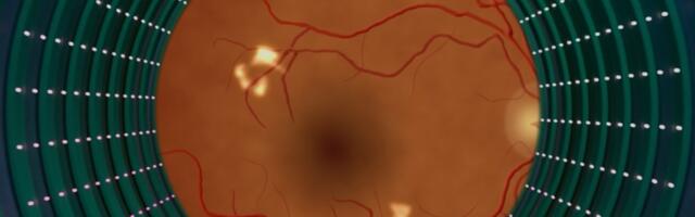 As AI eye exams prove their worth, lessons for future tech emerge