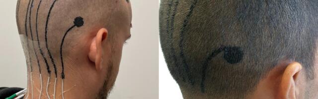 These Temporary Tattoos Can Read Your Brainwaves