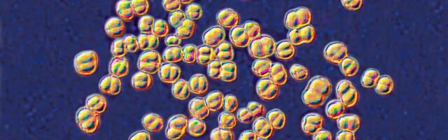 College lab class ends with 32 people on antibiotics for deadly germ exposure
