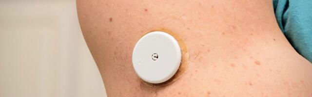 New surgeon general nominee cofounded ‘biowearables’ startup with DOGE operative