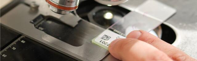 French AI biotech unicorn Owkin has launched a €33 million AI-powered precision medicine project for cancer diagnosis and treatment