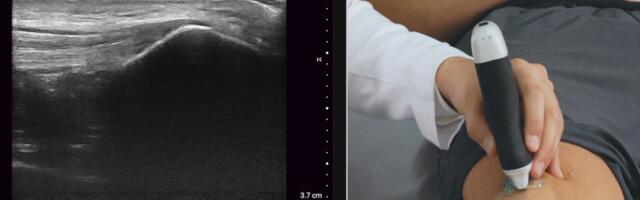 Clarius Mobile Health partners with Novartis to deploy ultrasound scanners to Canadian rheumatologists