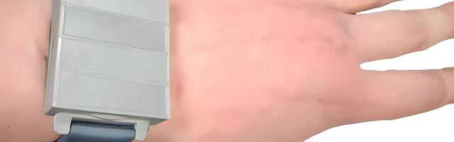 This device looks like a smartwatch, but it measures something far more sinister