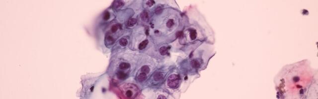 A Common Virus Causes Cancer, but Most Americans Are Clueless About It