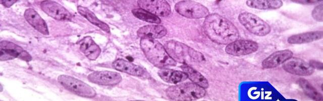 Can Vaccines Really Help Prevent Dementia?