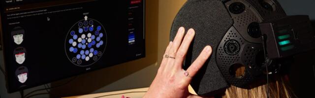 I let Bryan Johnson's startup scan my brain