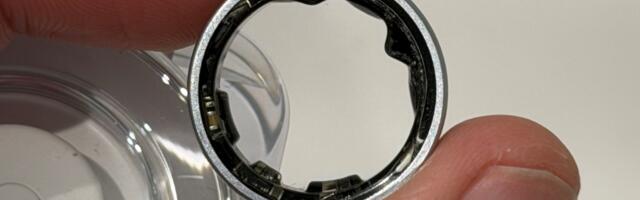 Galaxy Ring swelling victim shows aftermath and points to another case