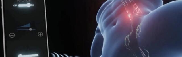 That Problem Where You Can’t Buy an Electrical Pulse-Delivering Patch for Your Taint Has Been Solved