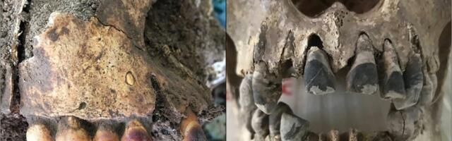 2,000-Year-Old Skulls Reveal How Vietnam’s Early Influencers Dyed Their Teeth Pitch Black—For Life