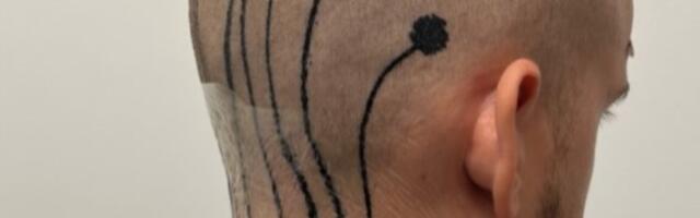 E-tattoos could make mobile EEGs a reality