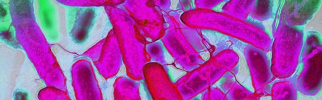 Resistant Bacteria Are Advancing Faster Than Antibiotics