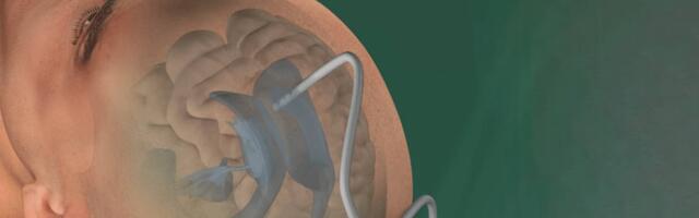 Swiss MedTech startup Rhovica raises €2.5 million for emergency neurosurgical device