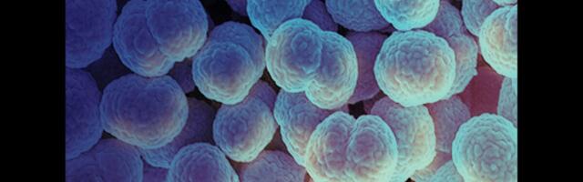 Alaskan Woman’s Death From Gonorrhea Sparks Fears of a New Strain