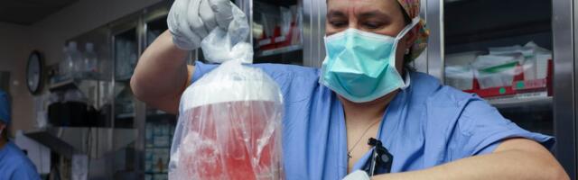 Pig kidney transplants are cool. They shouldn’t be necessary.